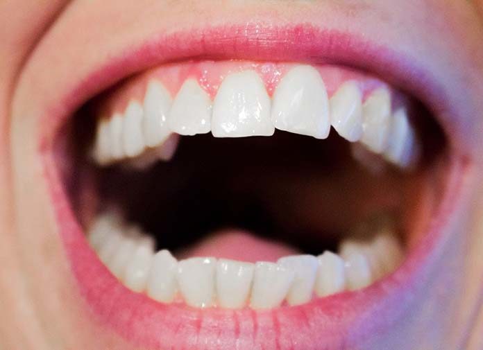 Kiedy udać się do ortodonty?