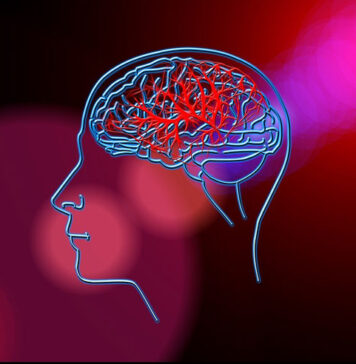 Udar mózgu - przyczyny, objawy, rehabilitacja