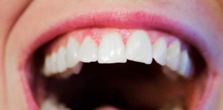Kiedy udać się do ortodonty?