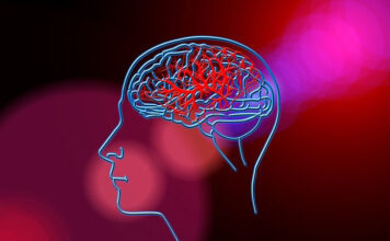 Udar mózgu – przyczyny, objawy, rehabilitacja Udar mózgu - przyczyny, objawy, rehabilitacja